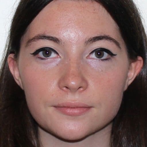 Axelle